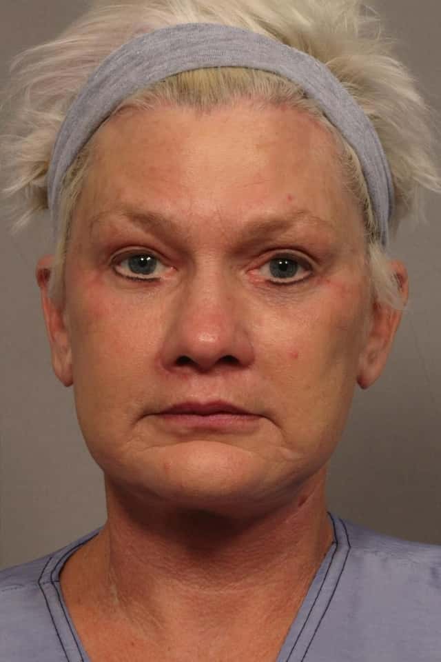 Total Facial Rejuvenation with Facelift, Brow and Eyelid lift, Before and After at 3 months by Dr. Hasen