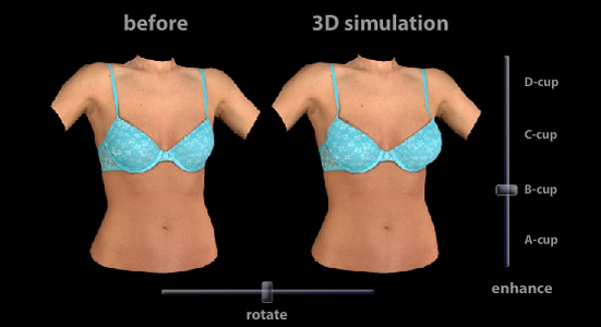 VECTRA® 3-D Plastic Surgery Imaging for Naples & Fort Myers, FL – Kent V.  Hasen, MD